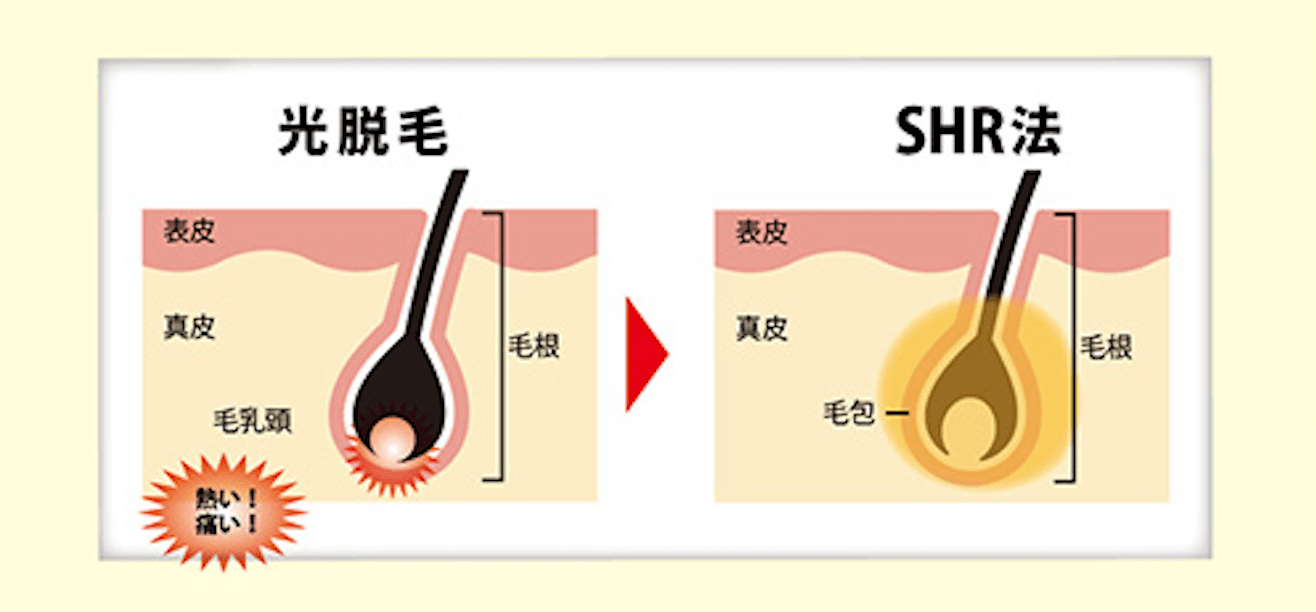 ルミクスA９の魅力２
