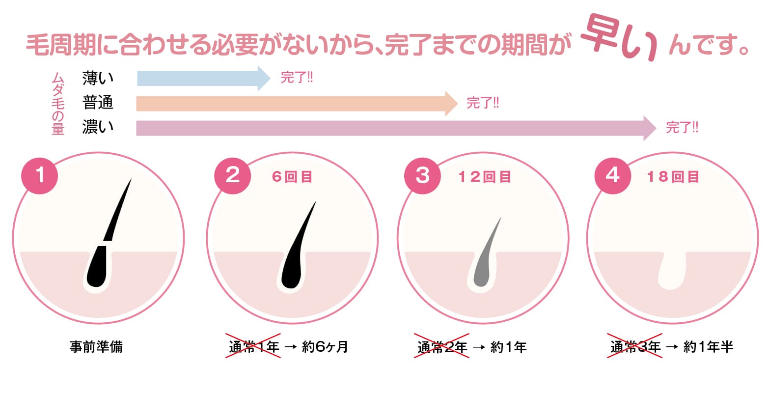 ルミクスA９の魅力１
